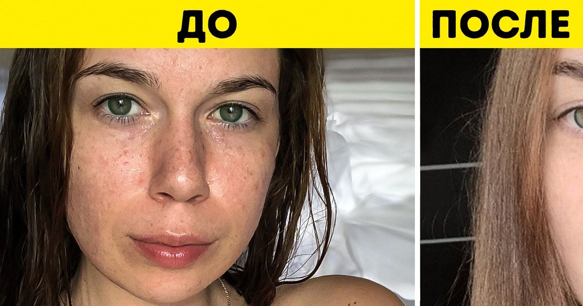 Отказ от сахара до и после фото женщины по дням