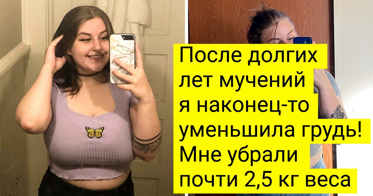 17 решительных людей, которых ничто не остановило на пути к внешности мечты 17 решительных людей, которых ничто не остановило на пути к внешности мечты