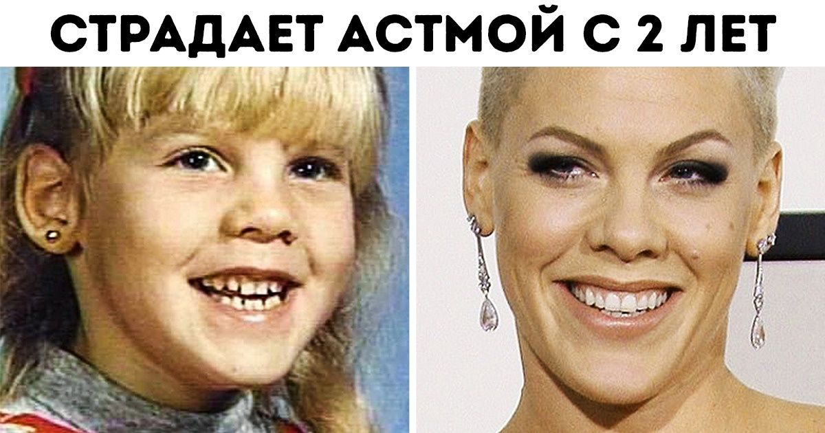 10 знаменитостей, для которых трудное детство не стало помехой на пути к славе