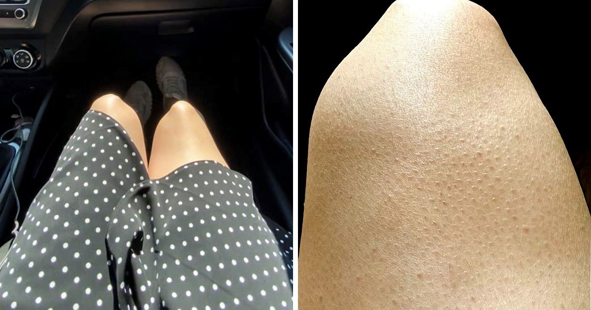 9 особенностей внешности, которые многие женщины считают недостатками. И абсолютно зря 9 особенностей внешности, которые многие женщины считают недостатками. И абсолютно зря