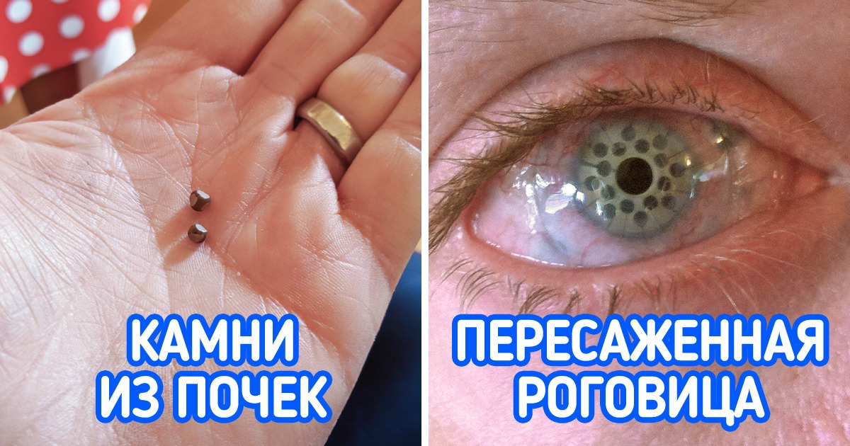 15+ фотодоказательств того, что тело человека поразительнее, чем можно представить 15+ фотодоказательств того, что тело человека поразительнее, чем можно представить