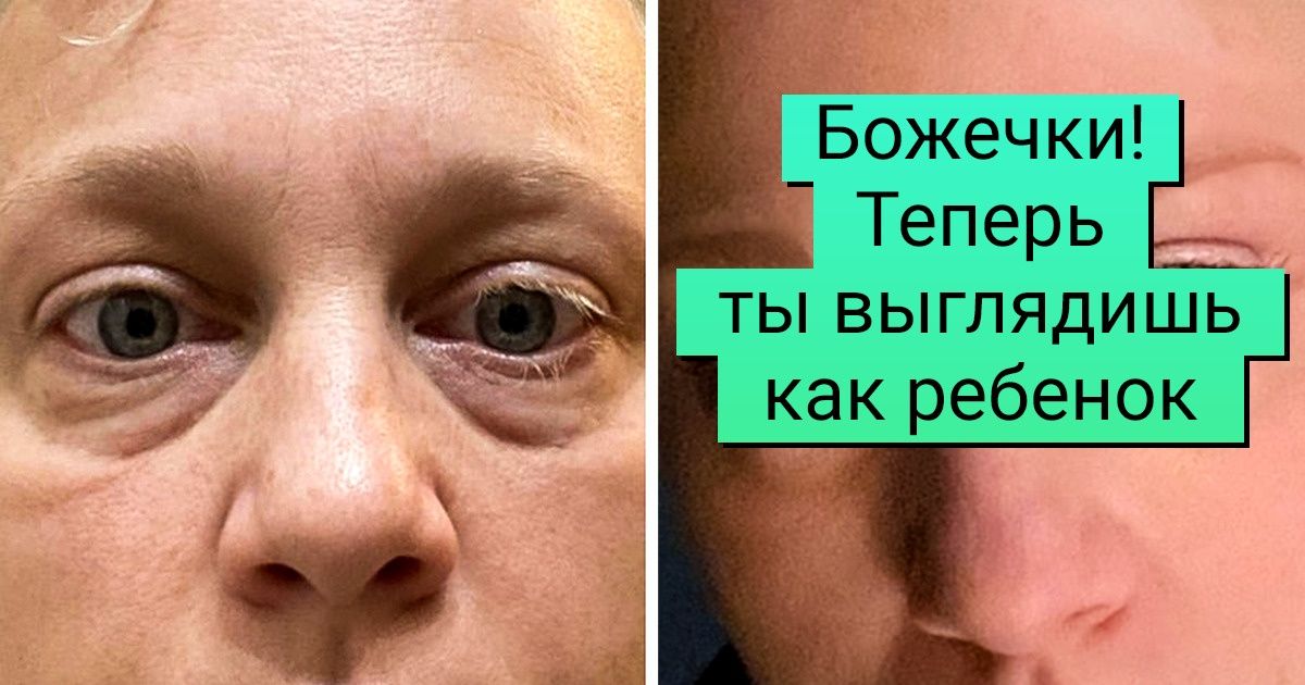 20+ человек, которые подумали: «Да надоело!» — и отправились к пластическому хирургу 20+ человек, которые подумали: «Да надоело!» — и отправились к пластическому хирургу