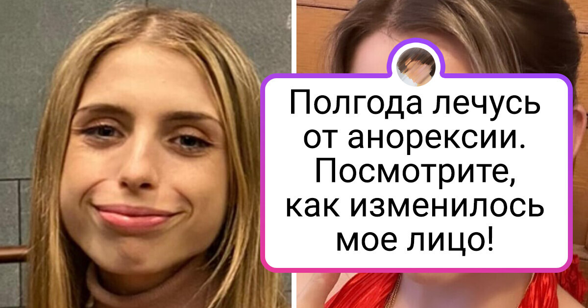 20+ фотографий с такой разницей, что их хочется рассмотреть повнимательнее 20+ фотографий с такой разницей, что их хочется рассмотреть повнимательнее