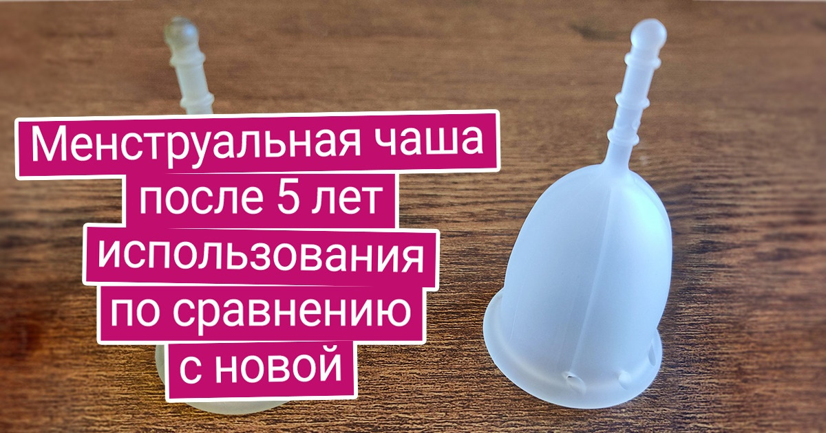 20 впечатляющих фото до и после, которые объясняют работу времени нагляднее тысячи слов 20 впечатляющих фото до и после, которые объясняют работу времени нагляднее тысячи слов
