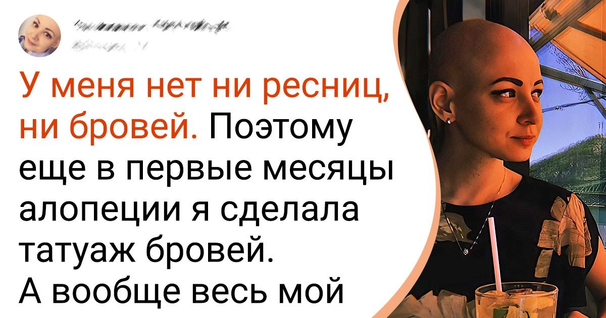В 19 лет я потеряла все волосы из-за алопеции, но смогла принять свою особенность и полюбить новую себя В 19 лет я потеряла все волосы из-за алопеции, но смогла принять свою особенность и полюбить новую себя
