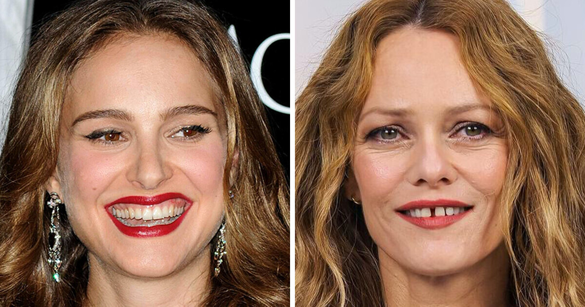 17 звезд, которые плевали на голливудские стандарты красоты, и вовсю хвастаются своей особенной улыбкой