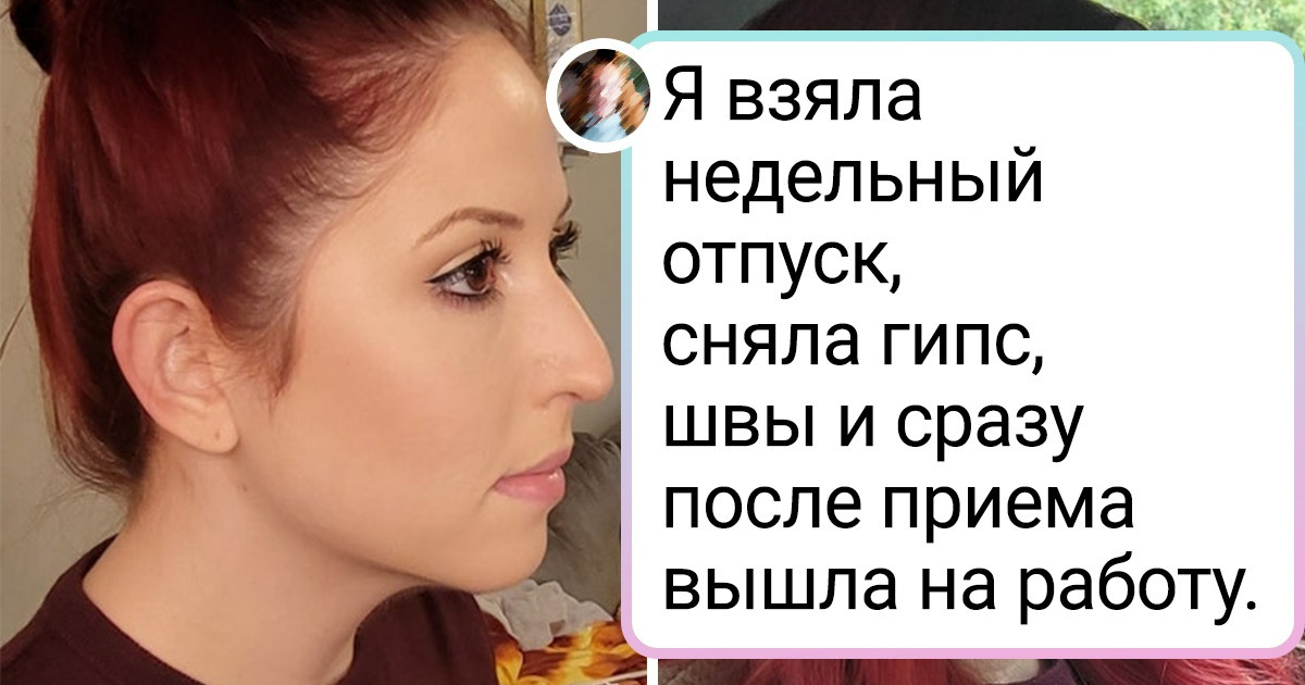 15+ человек, которые если о чем и пожалели, так о том, что не решились на пластику раньше 15+ человек, которые если о чем и пожалели, так о том, что не решились на пластику раньше