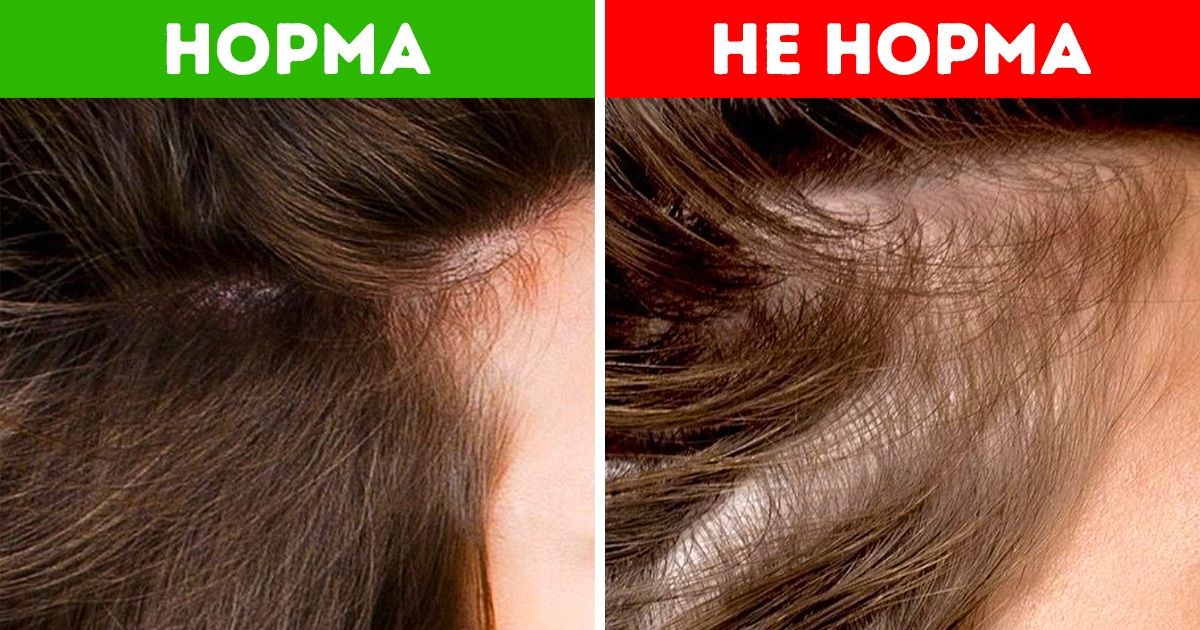 Что состояние волос может рассказать о вашем здоровье / AdMe