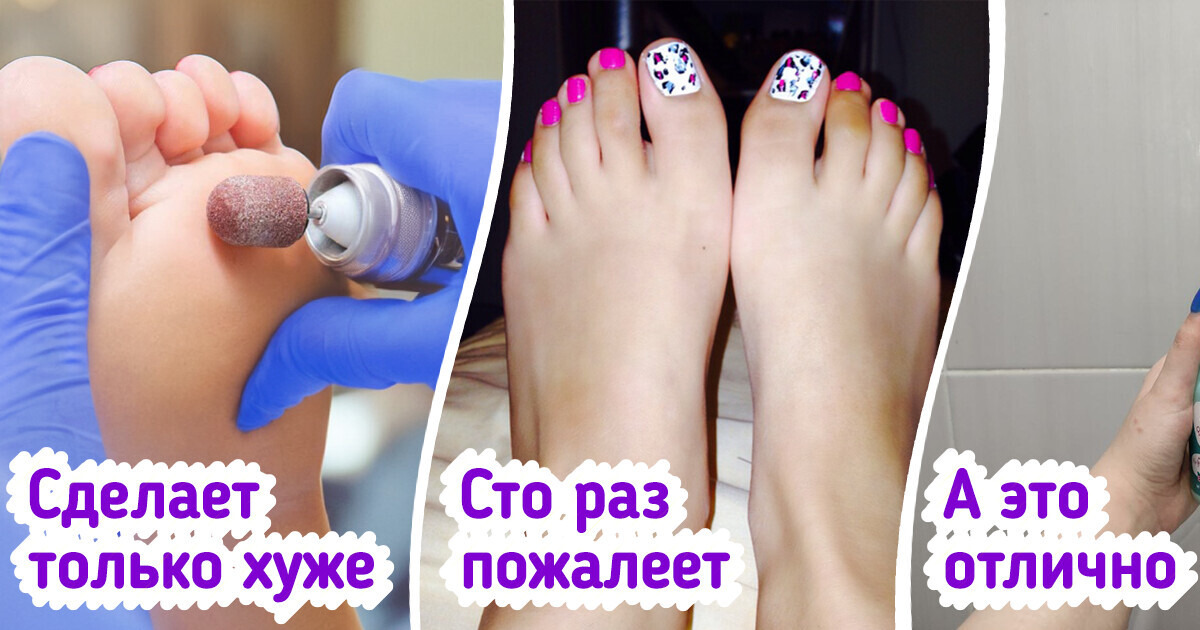 8 примеров того, как порой важно ухаживать за ногами 8 примеров того, как порой важно ухаживать за ногами