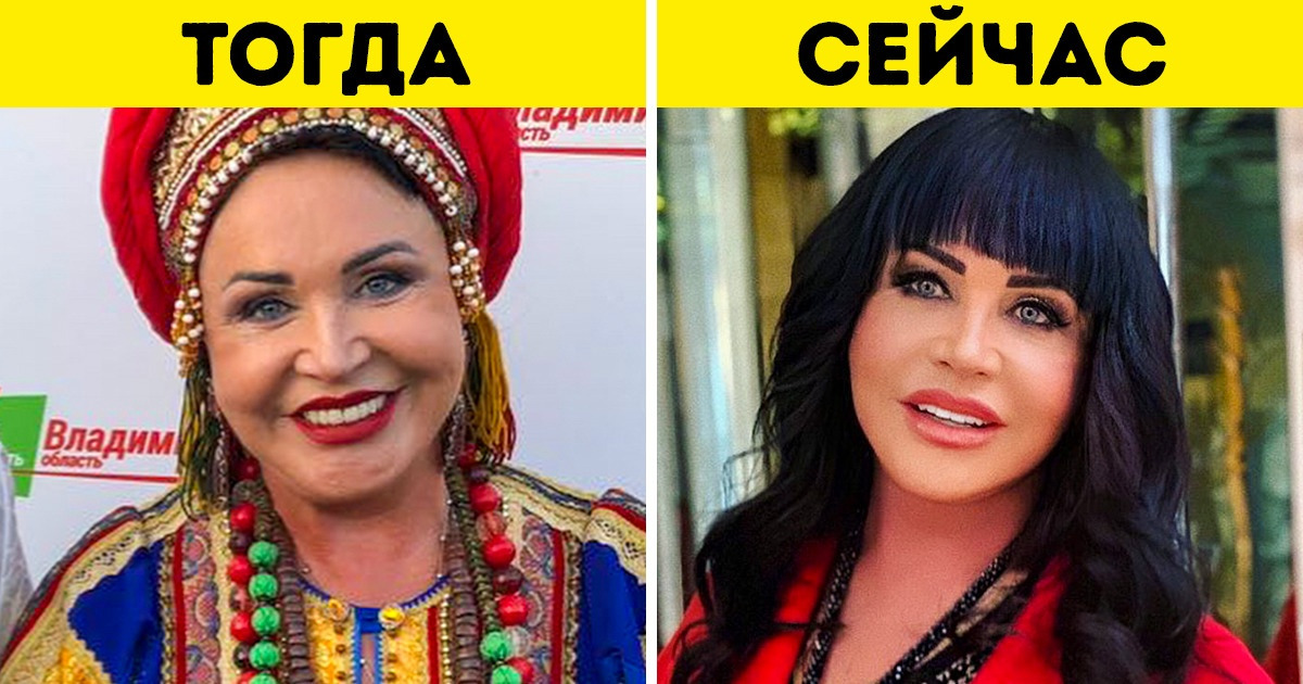 9 звезд, которые резко помолодели. Теперь фанаты узнают их с трудом 9 звезд, которые резко помолодели. Теперь фанаты узнают их с трудом