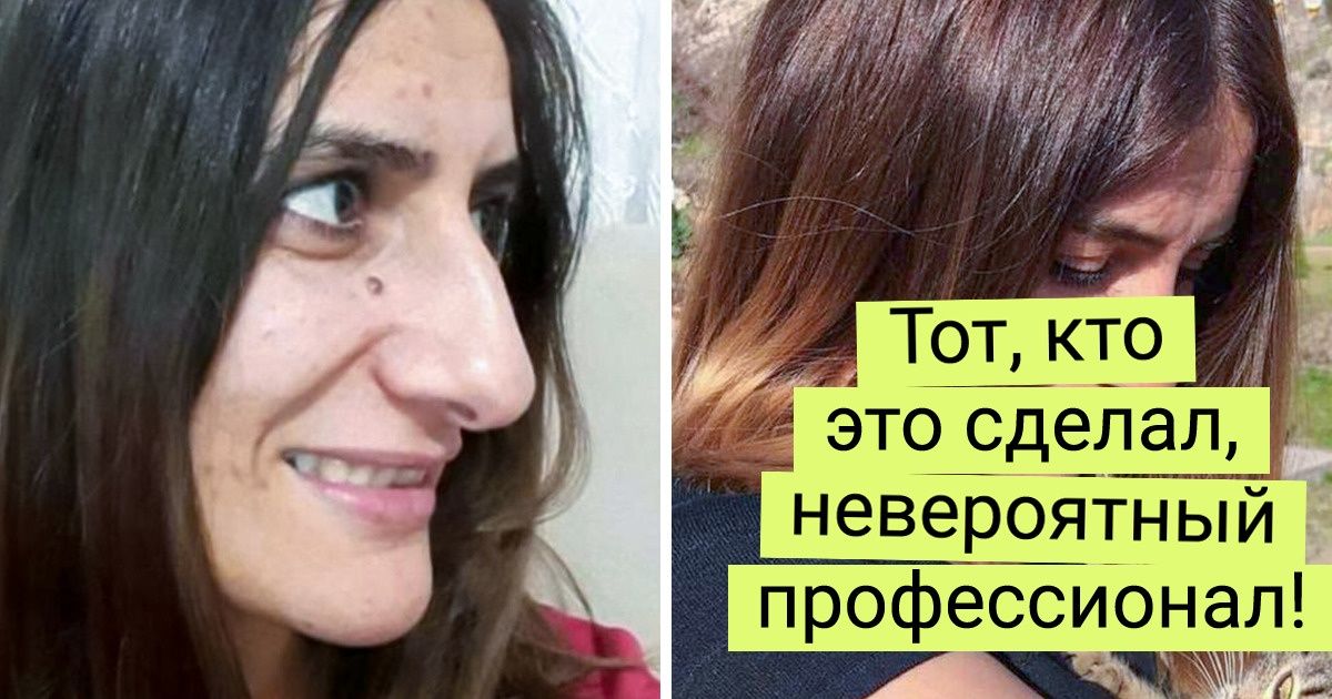 20+ отчаянных девушек, которые однажды сказали себе: «Хватит это терпеть!» — и сделали пластику 20+ отчаянных девушек, которые однажды сказали себе: «Хватит это терпеть!» — и сделали пластику
