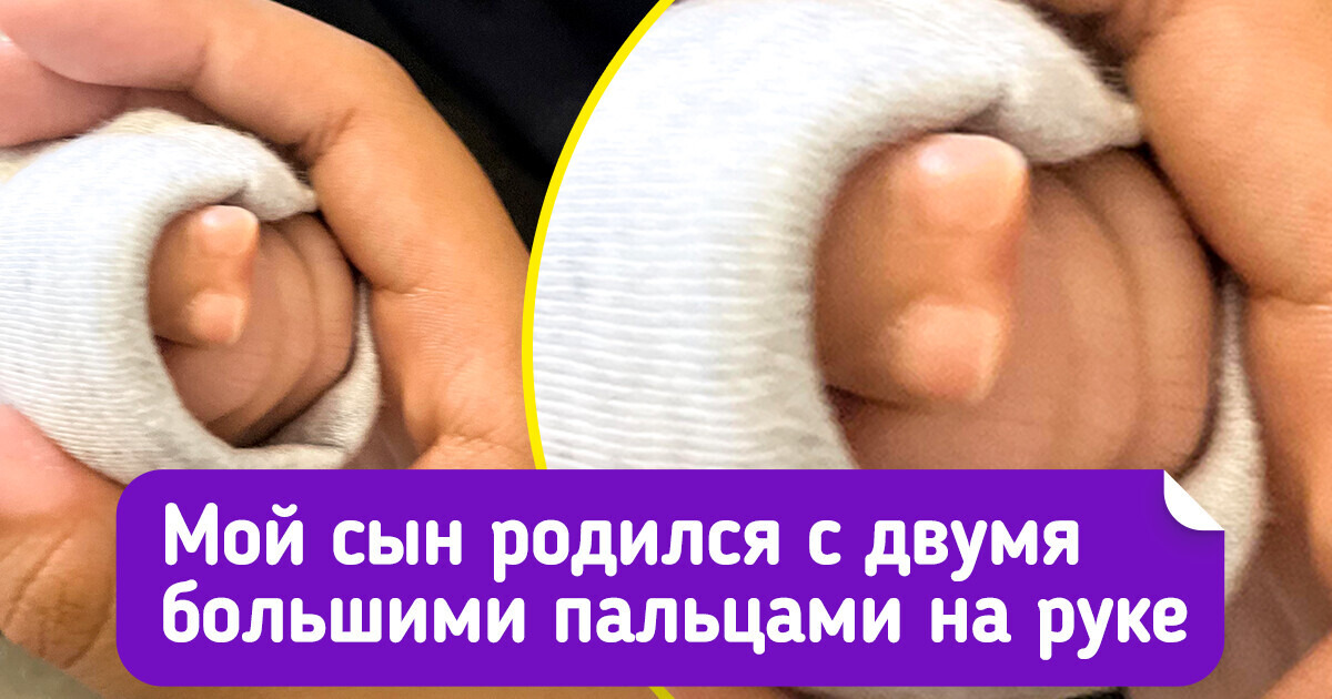 15 человек, которые на собственном опыте узнали, какие сюрпризы может преподнести мать-природа 15 человек, которые на собственном опыте узнали, какие сюрпризы может преподнести мать-природа