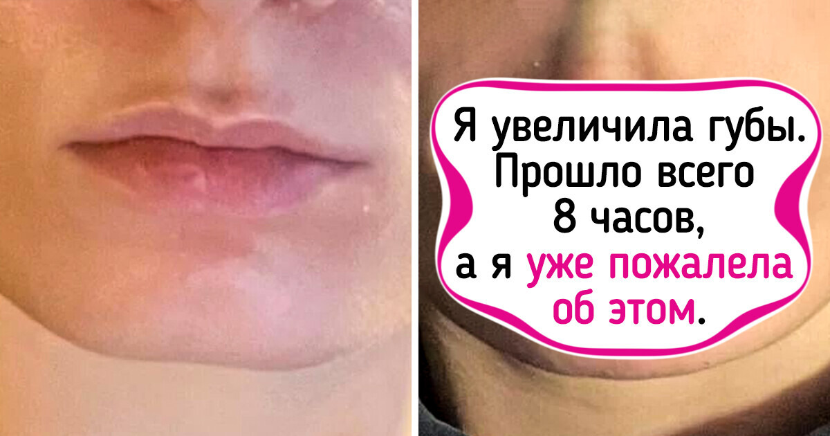 18 фото, которые лучше тысячи слов объясняют, что такое большая разница 18 фото, которые лучше тысячи слов объясняют, что такое большая разница