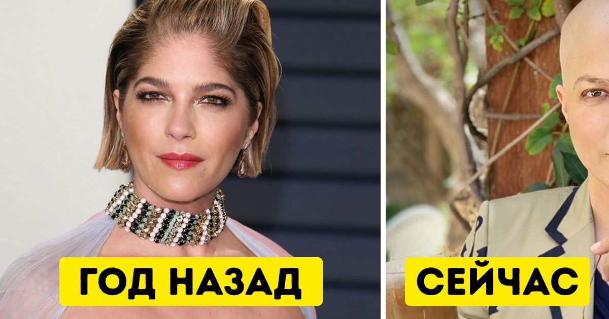 9 сильных женщин, которые смогли пережить серьезные испытания и вопреки пересудам остаться счастливыми 9 сильных женщин, которые смогли пережить серьезные испытания и вопреки пересудам остаться счастливыми