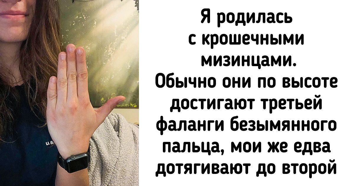 17 человек без стеснения показали, какими изюминками их наградила природа 17 человек без стеснения показали, какими изюминками их наградила природа