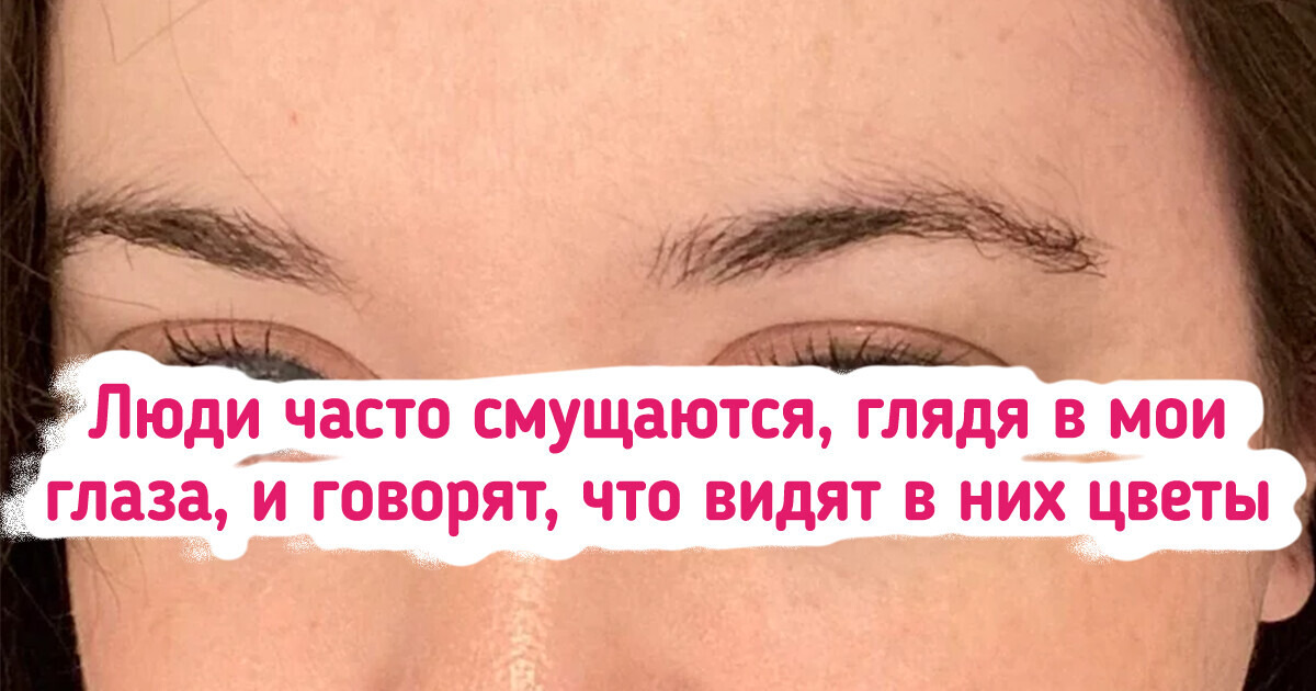 18 людей, которым генетика преподнесла исключительный подарок 18 людей, которым генетика преподнесла исключительный подарок