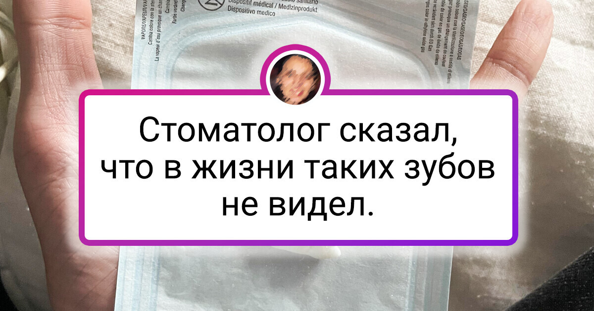 14 человек, которым генетика подкинула сюрприз 14 человек, которым генетика подкинула сюрприз