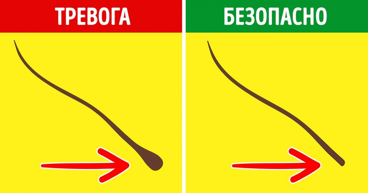 Не могу найти причину выпадения волос Не могу найти причину выпадения волос thumbnail