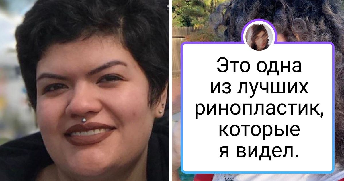 18 человек, которые не побоялись пойти на пластическую операцию и в итоге получили новую внешность