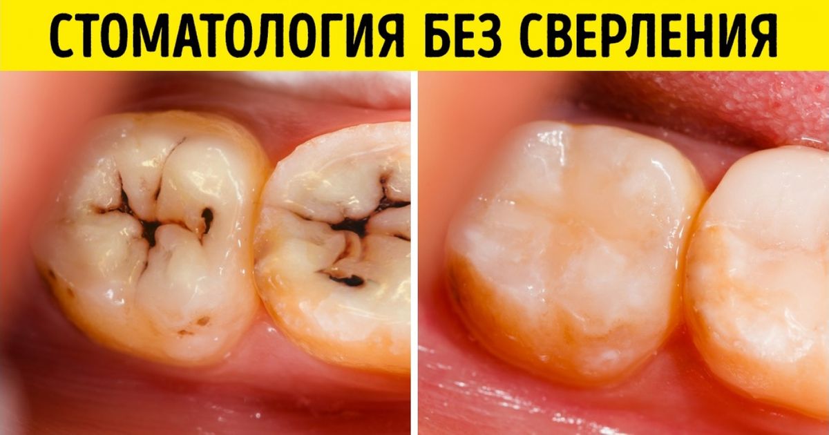 Что то новое и полезное изобретение thumbnail