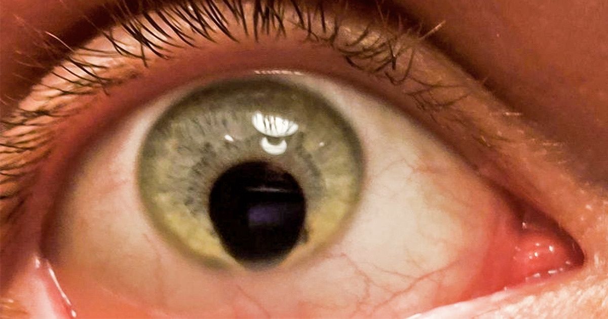 15 человек, которые не понаслышке знают, каково это — быть уникальным