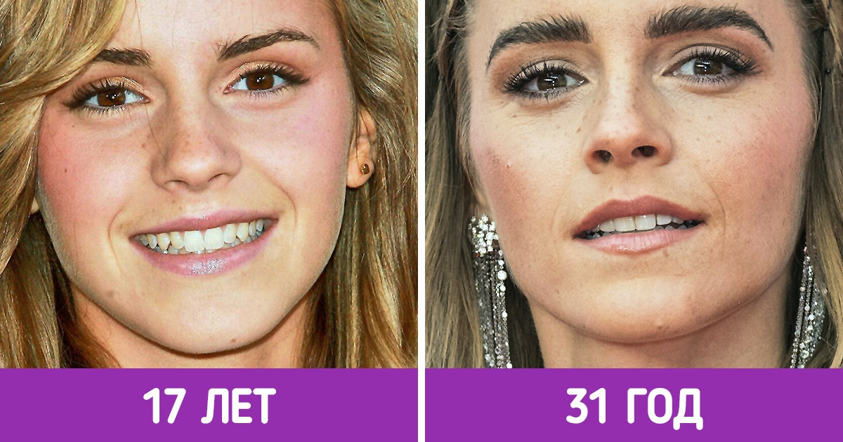 Мы приблизили фото 19 звезд, которые с подросткового возраста расцвели, словно сакура по весне Мы приблизили фото 19 звезд, которые с подросткового возраста расцвели, словно сакура по весне