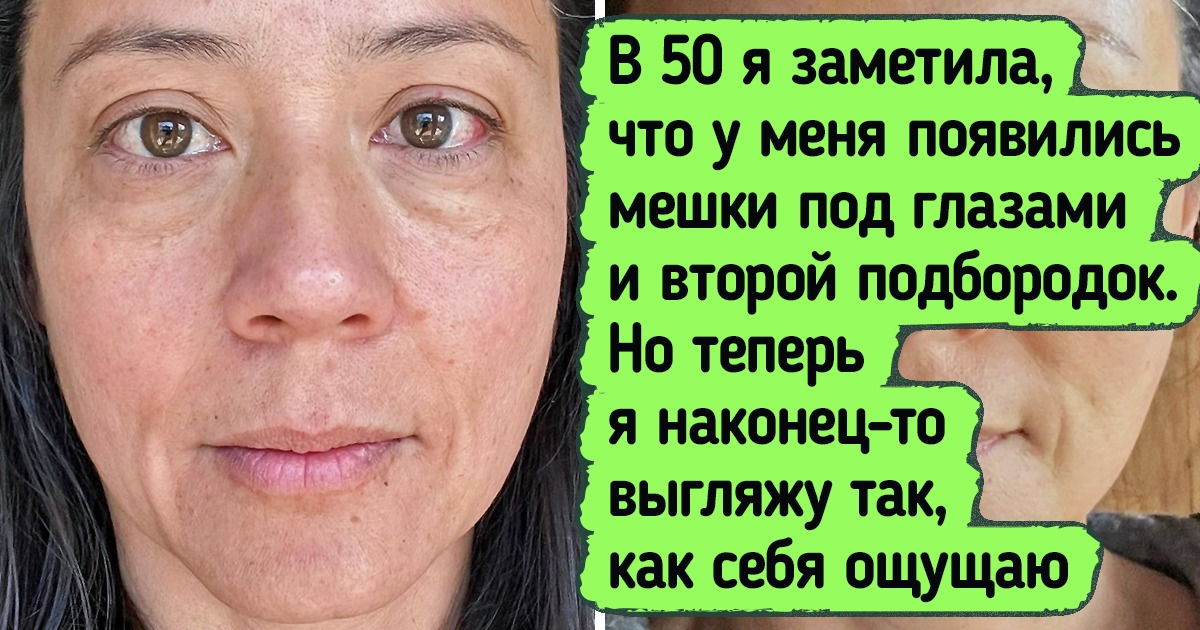 18 человек, которым до чертиков надоело себя стесняться. И они решились на кардинальные изменения 18 человек, которым до чертиков надоело себя стесняться. И они решились на кардинальные изменения