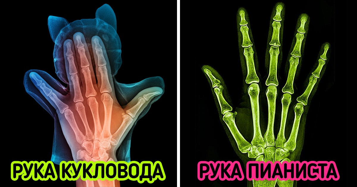 15 рентгеновских снимков, которые откроют этот мир с новой стороны 15 рентгеновских снимков, которые откроют этот мир с новой стороны