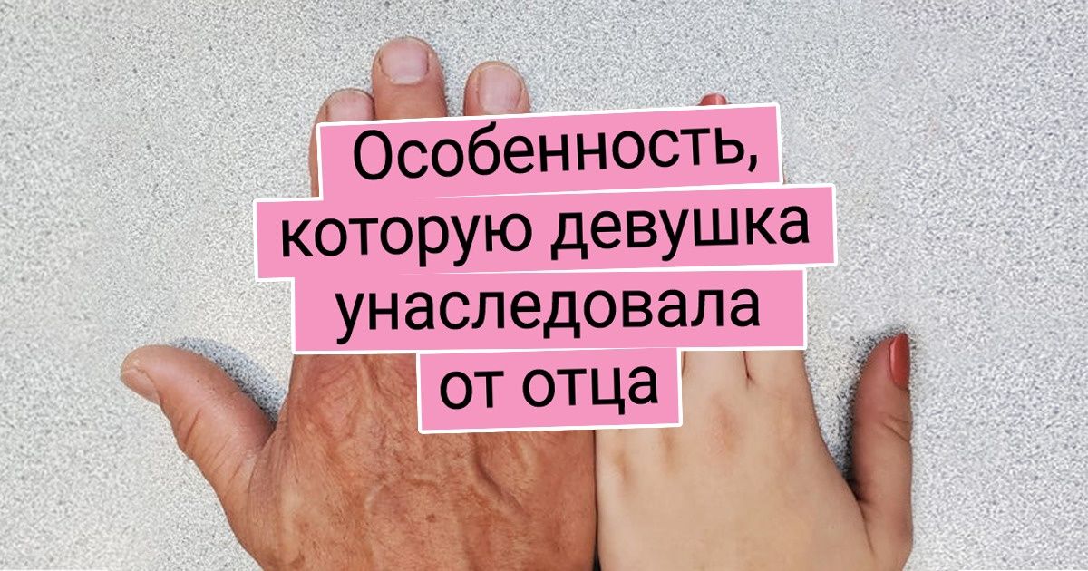 15 человек, создавая которых природа решила не идти по заданному шаблону, а немного пошалить 15 человек, создавая которых природа решила не идти по заданному шаблону, а немного пошалить