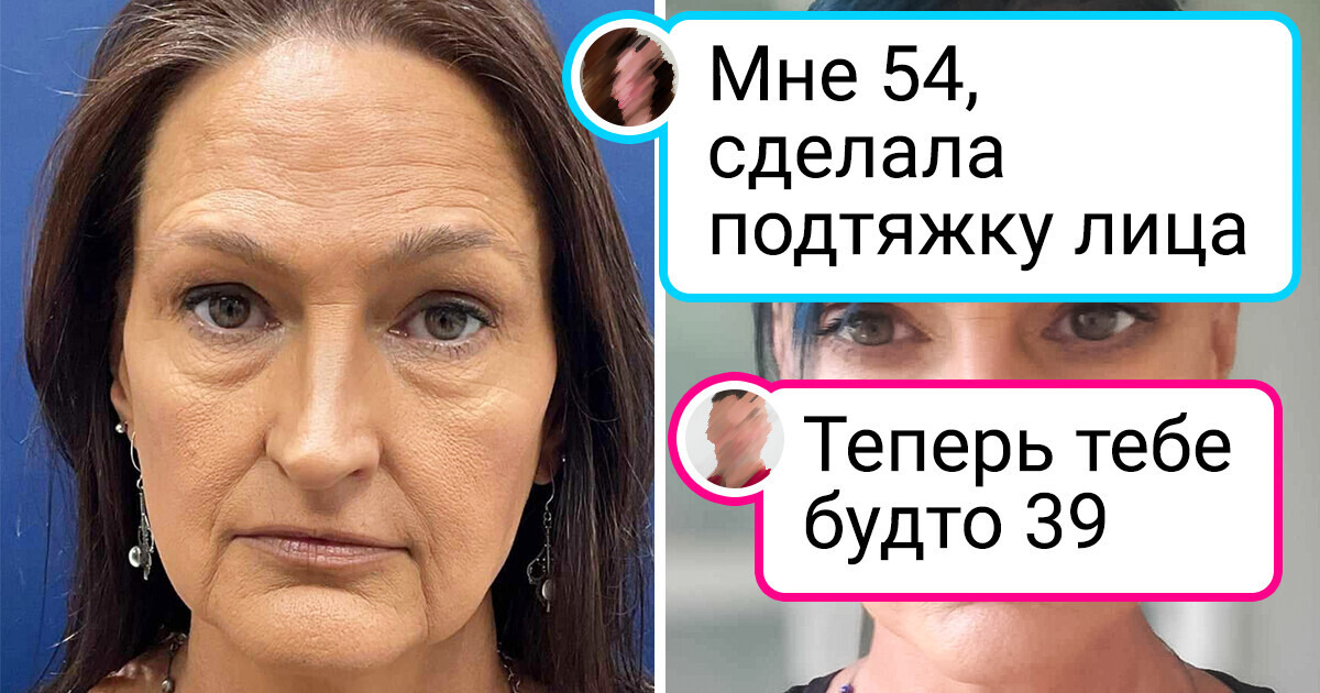 16 фотографий, на которых запечатлены большие перемены 16 фотографий, на которых запечатлены большие перемены