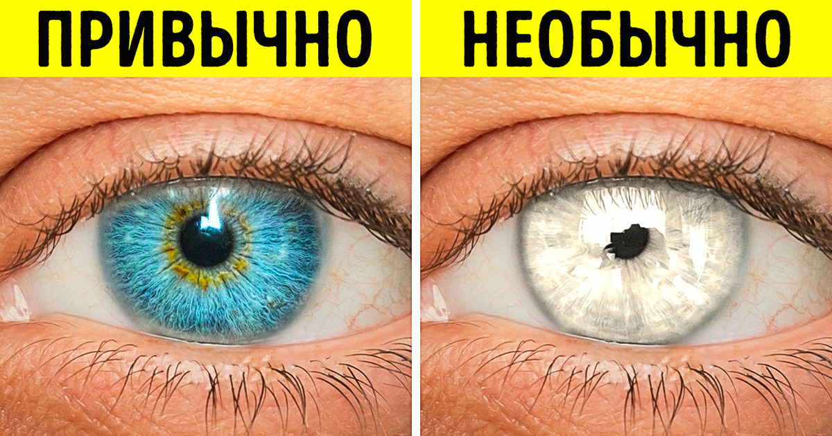 23 интересных факта о нашем теле