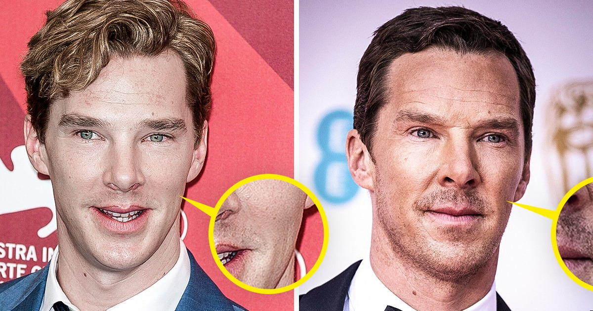 13 знаменитых мужчин, которые поработали над своей внешностью и стали еще краше 13 знаменитых мужчин, которые поработали над своей внешностью и стали еще краше