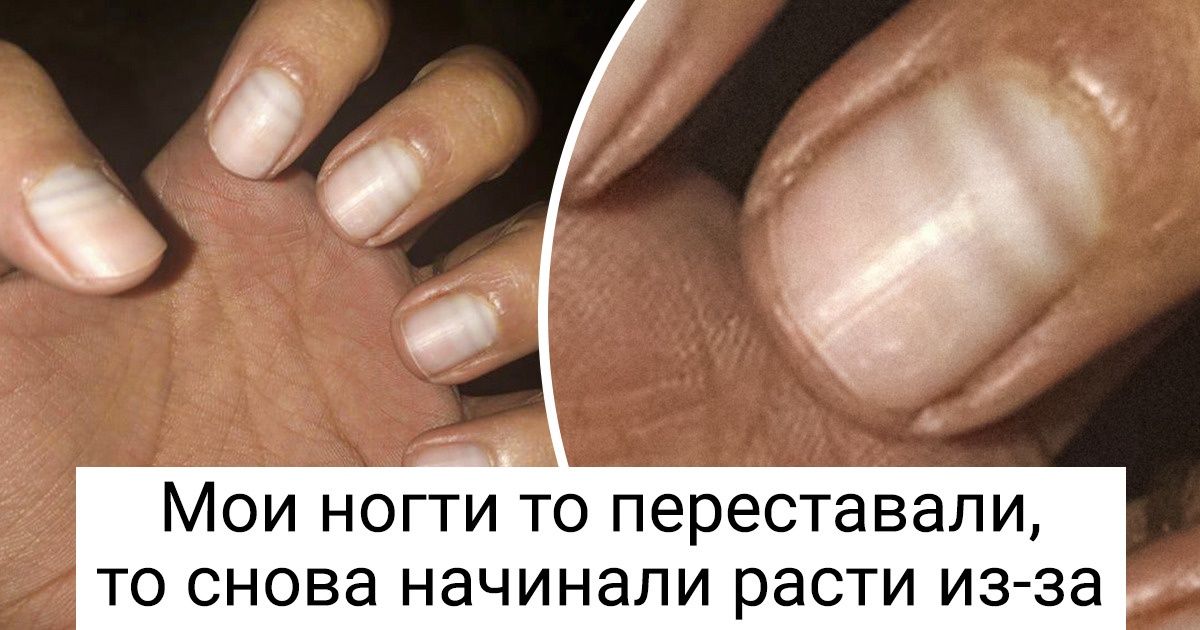 18 человек, которые подметили в себе какую-то особенность и поспешили сообщить об этом миру 18 человек, которые подметили в себе какую-то особенность и поспешили сообщить об этом миру