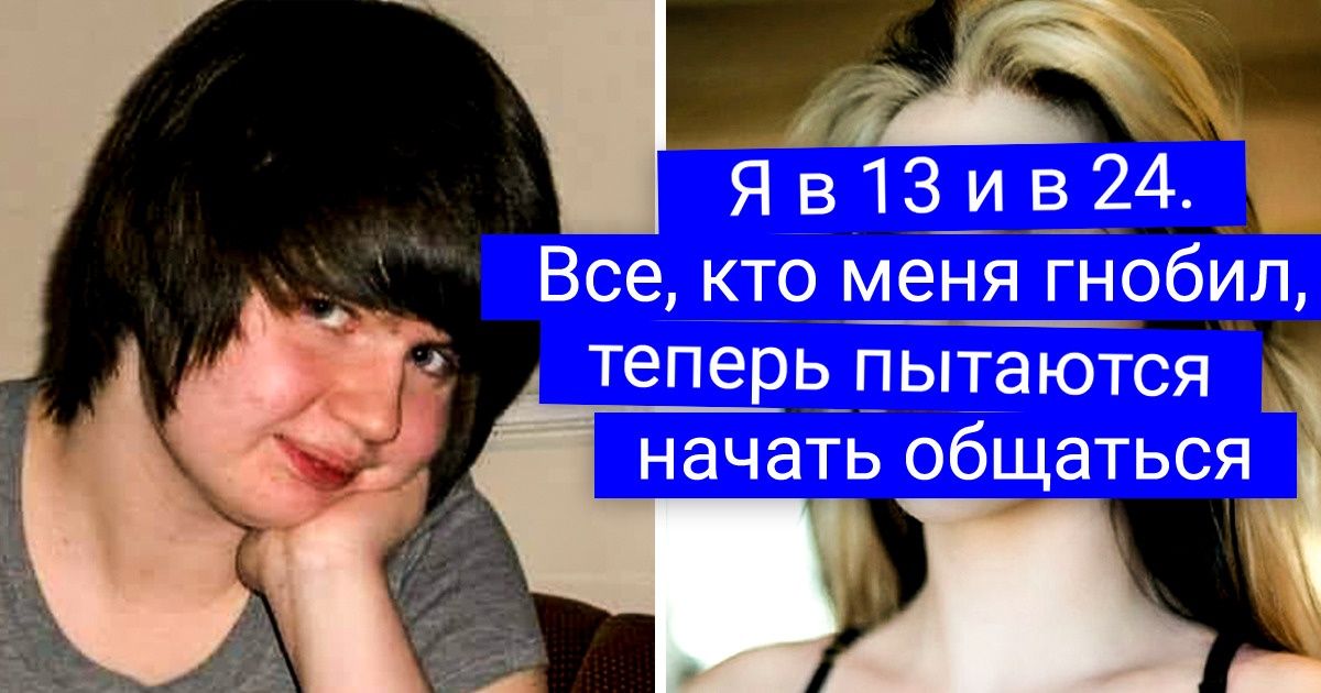 20+ счастливчиков, которые с годами расцвели так, что не узнает ни родня, ни школьные подруги