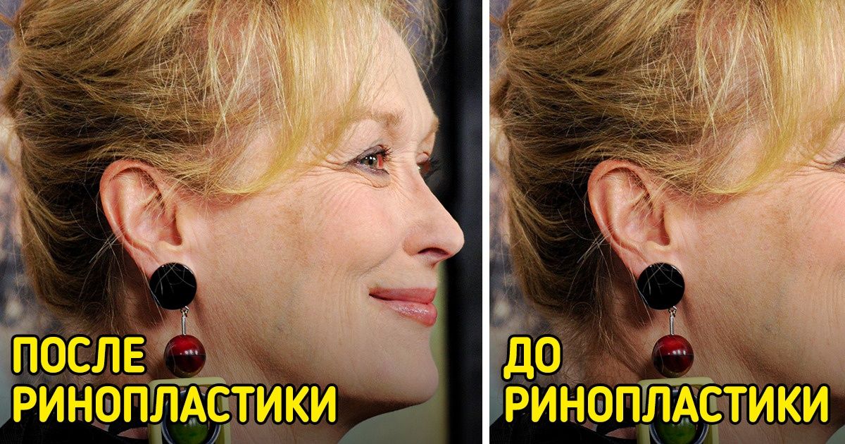 Как будут выглядеть знаменитости, если пойдут на поводу у моды и решатся на популярные бьюти-процедуры Как будут выглядеть знаменитости, если пойдут на поводу у моды и решатся на популярные бьюти-процедуры