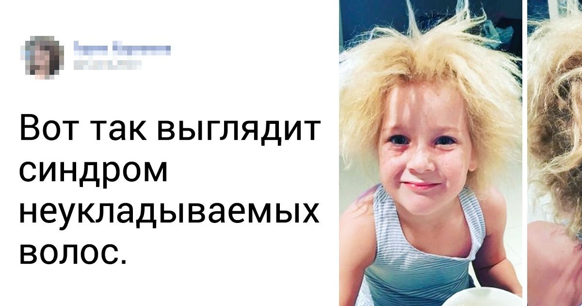 20+ человек с редкой внешностью, которые создали свой формат красоты