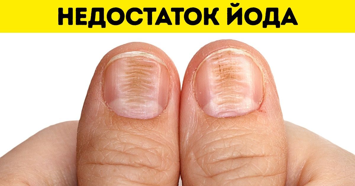 Гид по витаминам, которые отвечают за женскую красоту (И где их найти) Гид по витаминам, которые отвечают за женскую красоту (И где их найти)