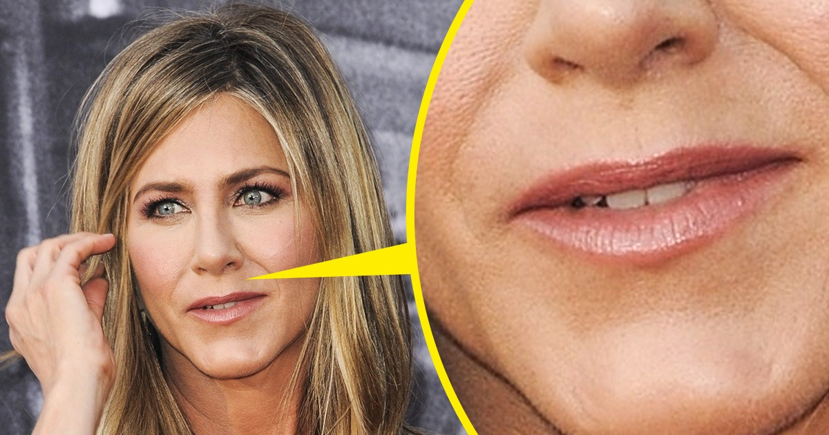 10 хитростей звезд, благодаря которым они сияют, как бриллиант на солнце 10 хитростей звезд, благодаря которым они сияют, как бриллиант на солнце