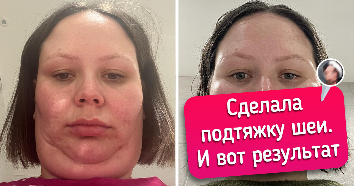 18 человек показали свои фото в стиле «было - стало», и разницу трудно не заметить 18 человек показали свои фото в стиле «было - стало», и разницу трудно не заметить