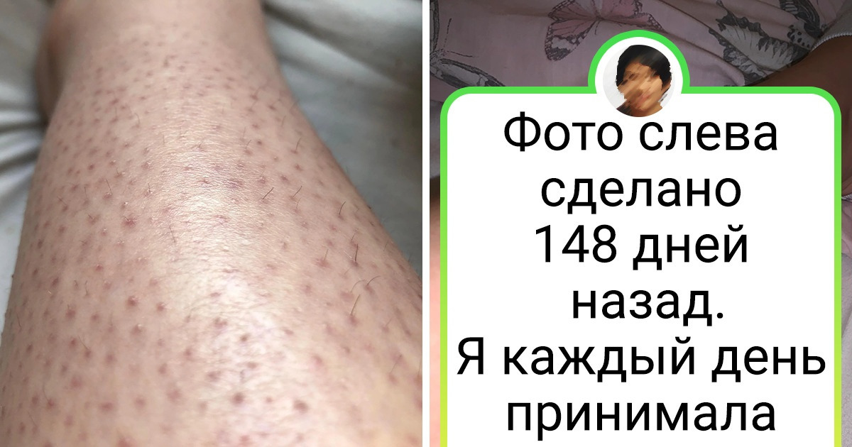 16 женщин, которые ухаживают за собой и добиваются результата, пока остальные только жалуются 16 женщин, которые ухаживают за собой и добиваются результата, пока остальные только жалуются