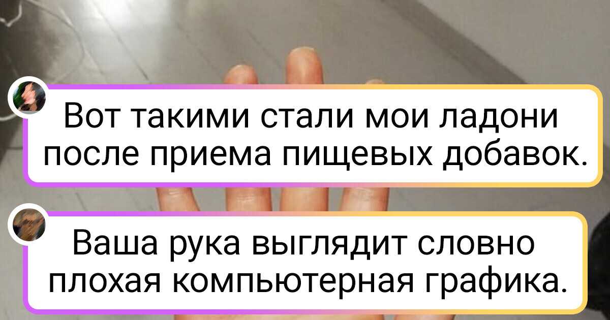 15+ фото, которые показывают, какие сюрпризы может преподнести человеческое тело