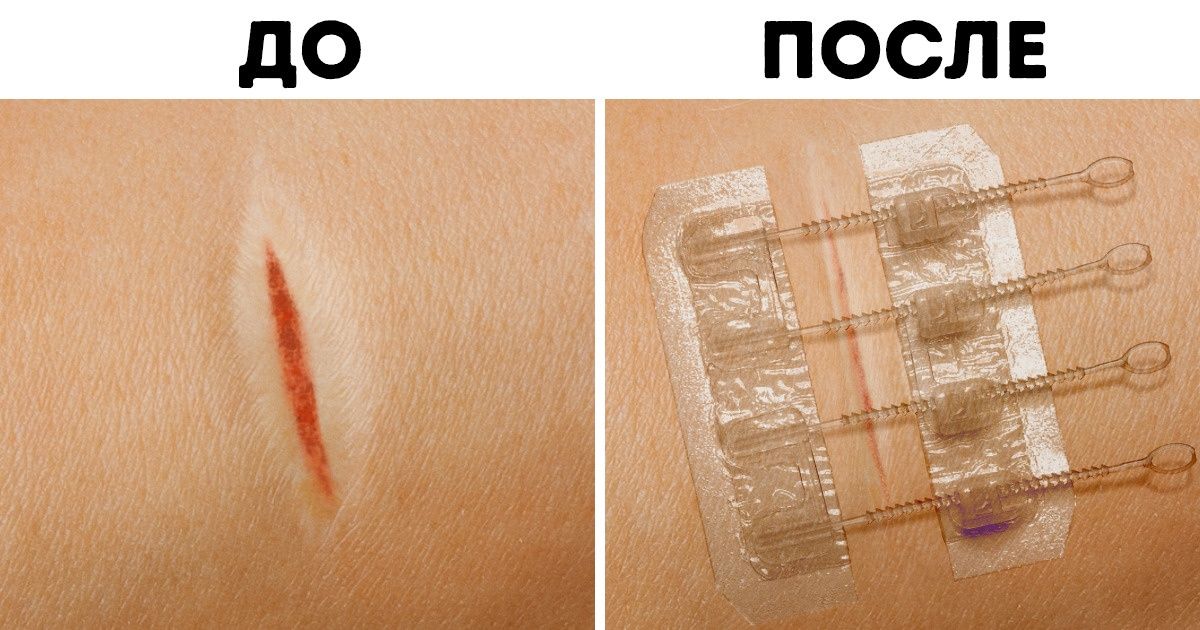 15 умных гаджетов, которые помогут вести ЗОЖ совершенно не напрягаясь 15 умных гаджетов, которые помогут вести ЗОЖ совершенно не напрягаясь