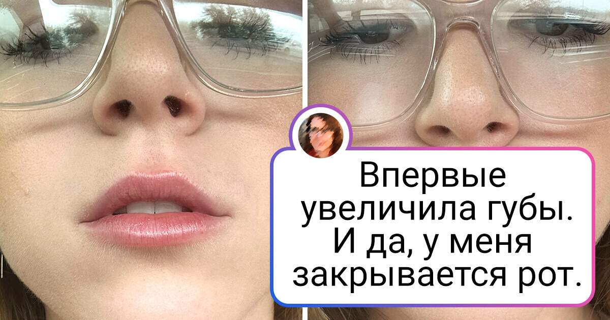 19 человек поделились фотографиями до и после того, как изменили всего одну деталь во внешности 19 человек поделились фотографиями до и после того, как изменили всего одну деталь во внешности