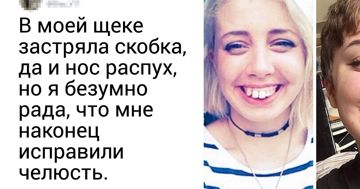 20+ человек, которым пришлось побороться за новую внешность и жизнь 20+ человек, которым пришлось побороться за новую внешность и жизнь