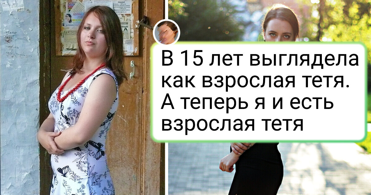 20 фото из разряда «до» и «после», на которых запечатлены разительные перемены