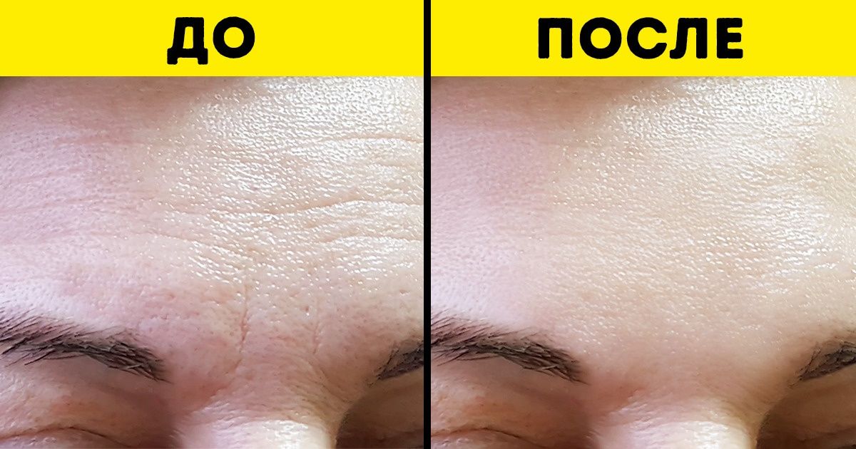 9 простых действий, которые можно выполнить в течение дня, чтобы выглядеть моложе и похудеть 9 простых действий, которые можно выполнить в течение дня, чтобы выглядеть моложе и похудеть