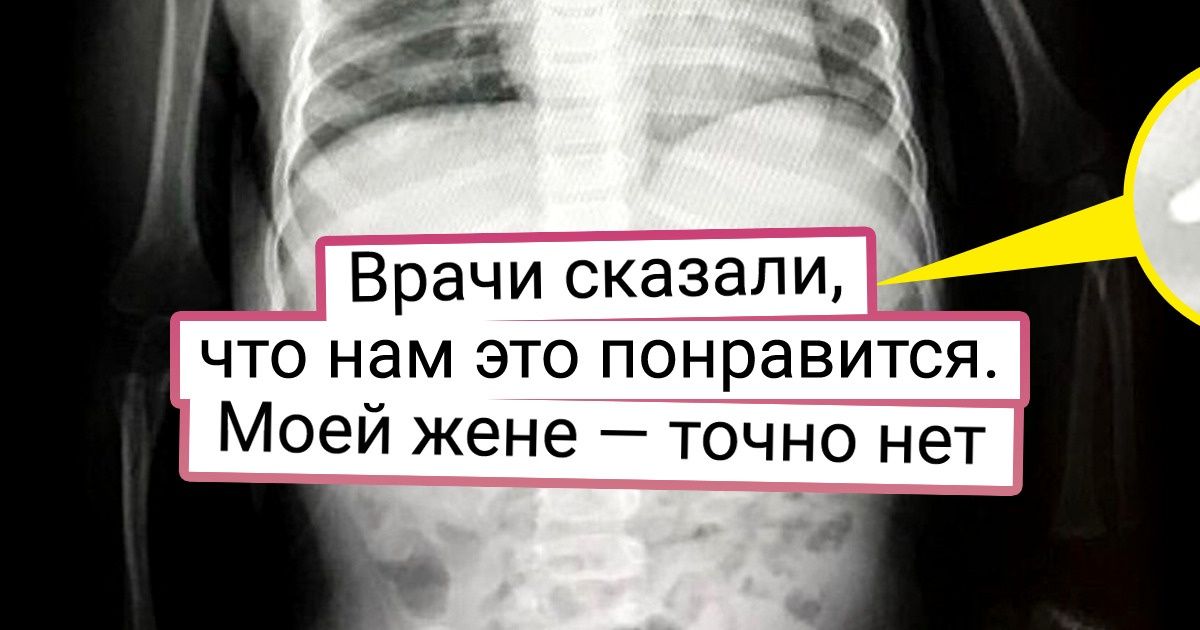18 случаев, когда рентген и УЗИ показали мир под таким углом, под каким обычному глазу ничего не разглядеть 18 случаев, когда рентген и УЗИ показали мир под таким углом, под каким обычному глазу ничего не разглядеть