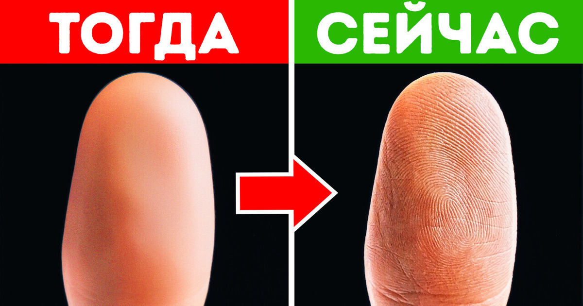 Поврежденные отпечатки пальцев восстанавливают тот же самый узор и другие факты о теле