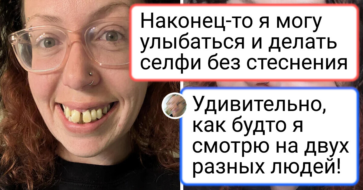 13 снимков, которые без лишних слов покажут невероятные преображения 13 снимков, которые без лишних слов покажут невероятные преображения