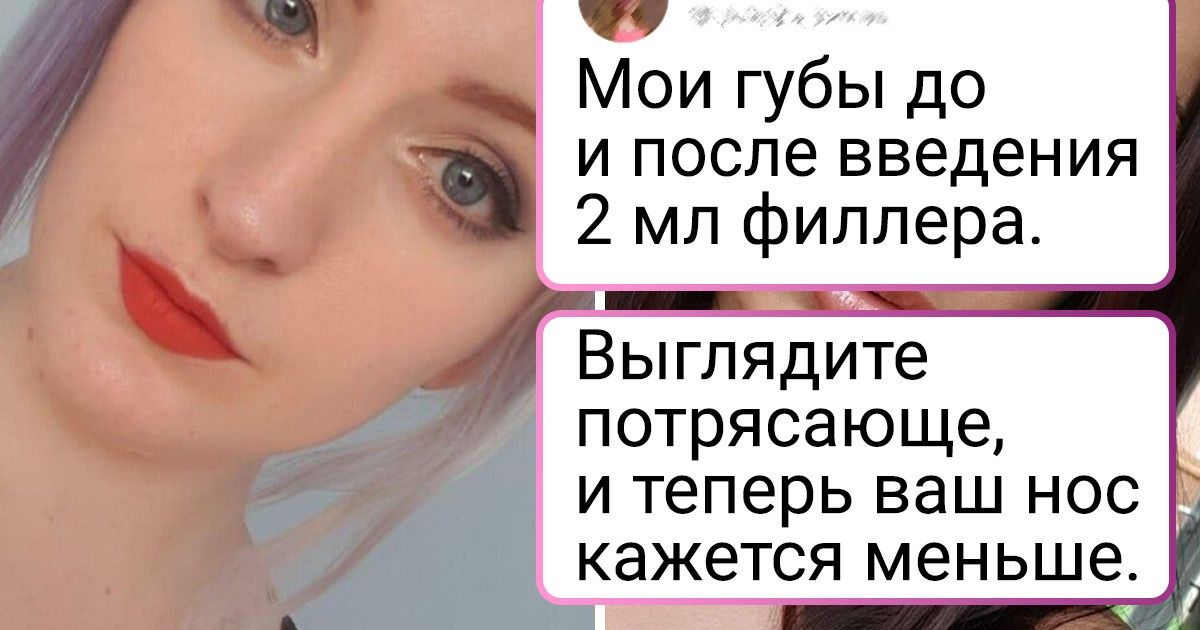 16 мощных примеров «до и после», которые мигом выведут вас из зимней спячки 16 мощных примеров «до и после», которые мигом выведут вас из зимней спячки